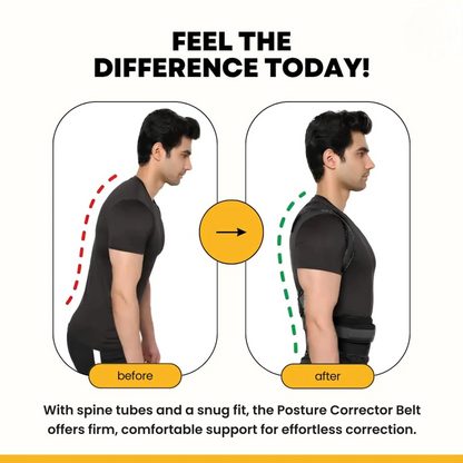 Unisex Posture Corrector Belt (UPCB)